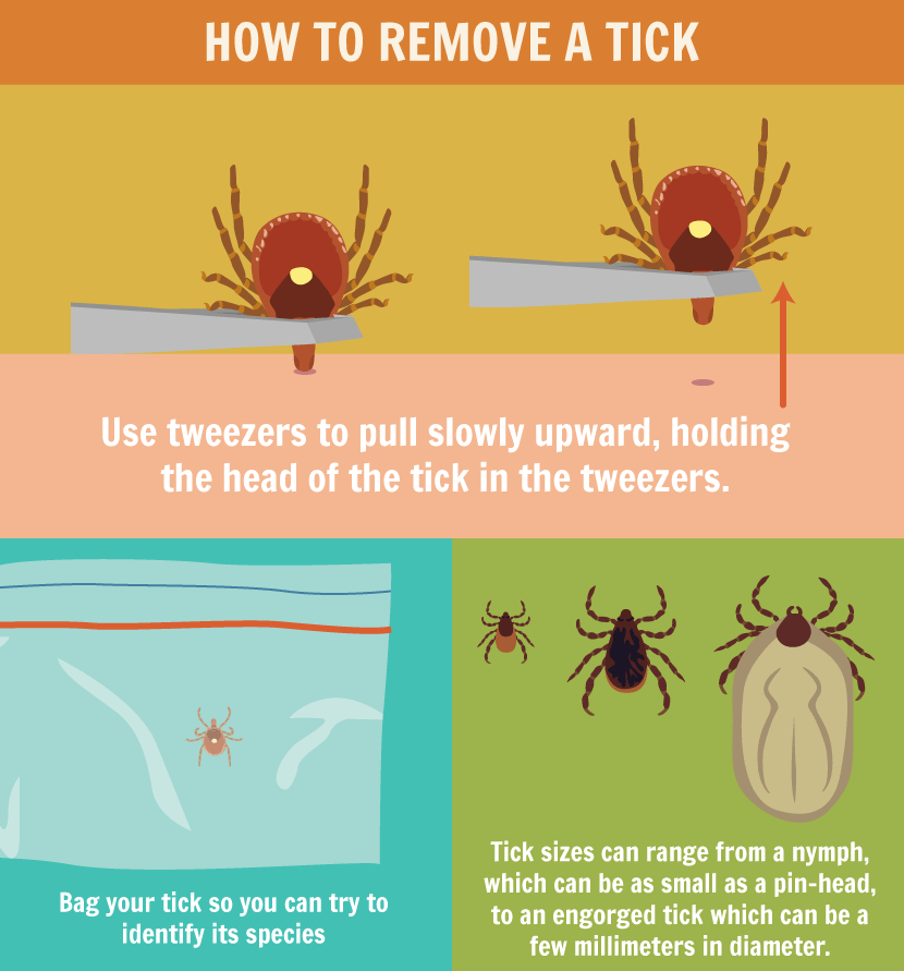 Remove Ticks Safely