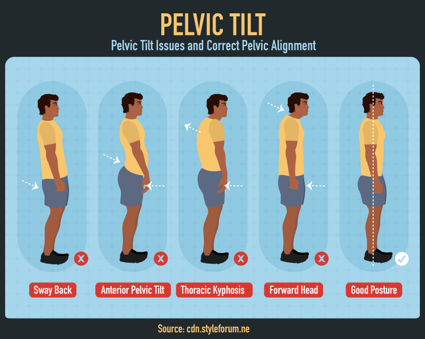 Pelvic Tilt - Perfect Posture from Toe to Head