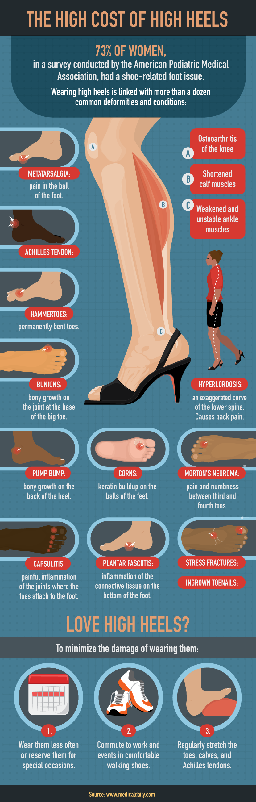 Cost of High Heels - How to Treat Your Feet