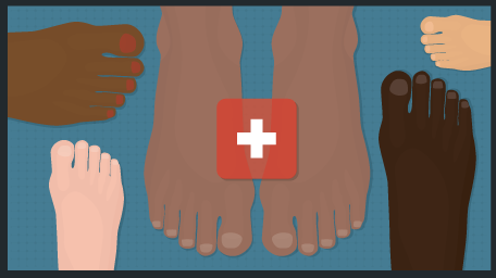 How to Treat Your Feet