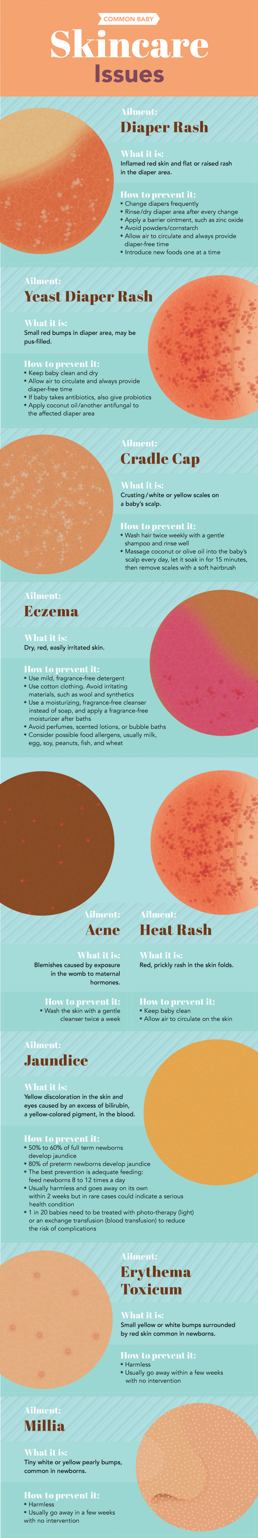 Skincare Issues - Seasonal Skincare for Baby