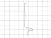 Choke Linkage – Part Number: 1207907-S